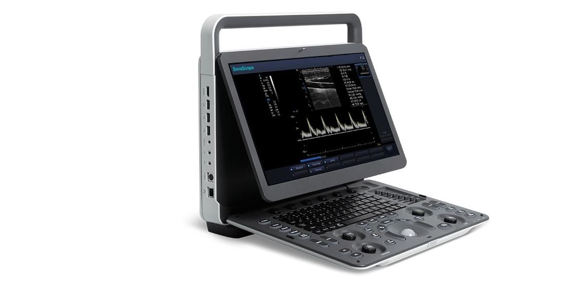 Ultrasuono portatile a 15,6 pollici di BW della macchina di ultrasuono di doppler di colore del LED SonoScape