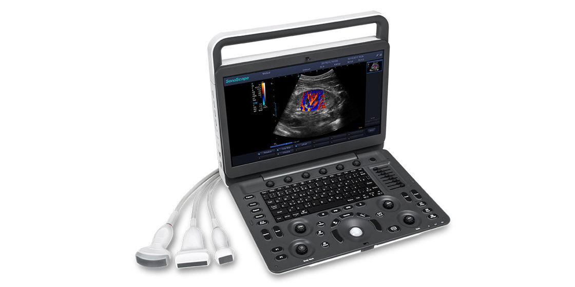 7 macchina portatile di ultrasuono di SonoScape E3 dei livelli di rappresentazione con il monitor a 15,6 pollici