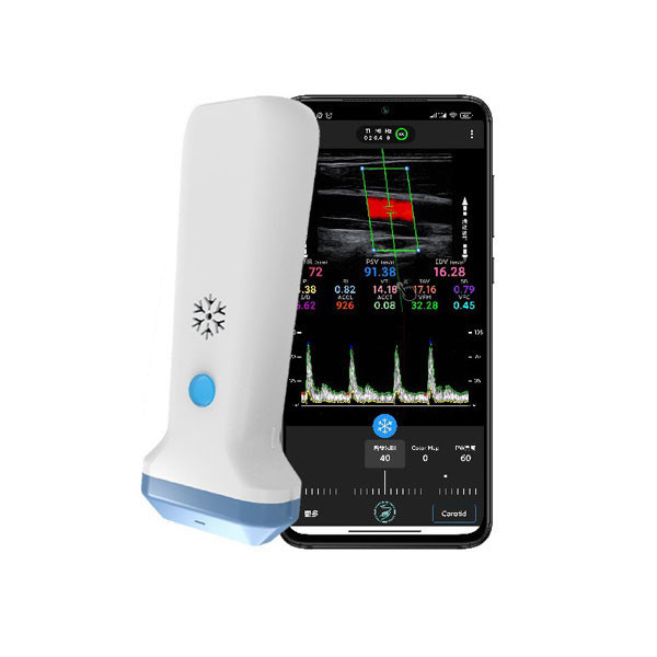 Scanner a ultrasuoni portatile lineare wireless | Sonda ecografica portatile Color Doppler 4/8,3/12 MHz