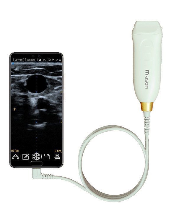 Scanner ecografico portatile a 20 mm di profondità per la valutazione vascolare periferica e l'accesso vascolare guidato da ultrasuoni
