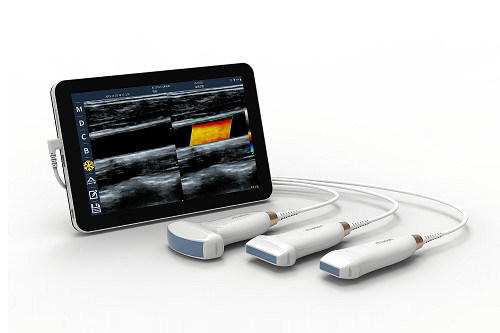 Sonda ad ultrasuoni portatile Android da 10 MHz per scanner ad ultrasuoni lineare USB tipo C per vascolare e POCUS