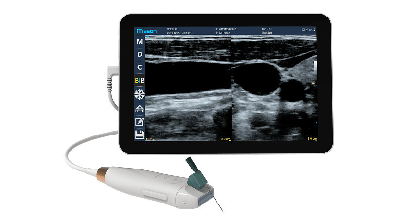 Scanner ad ultrasuoni portatile con sonda lineare ad alta frequenza 12MHZ per accurate procedure di accesso vascolare e inserimento PICC