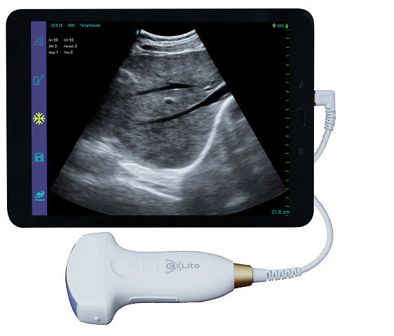 Analizzatore tenuto in mano 3.5MHz di ultrasuono di matrice di doppler convesso elettronico di colore