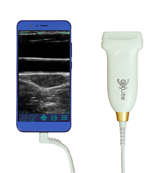 Sonda ad ultrasuoni portatile Android da 10 MHz per scanner ad ultrasuoni lineare USB tipo C per vascolare e POCUS