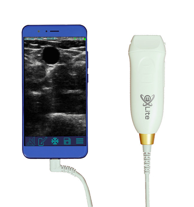 Scanner ad ultrasuoni portatile con sonda lineare ad alta frequenza 12MHZ per accurate procedure di accesso vascolare e inserimento PICC