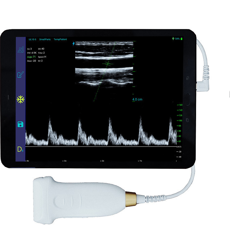 Sonda ad ultrasuoni portatile Android da 10 MHz per scanner ad ultrasuoni lineare USB tipo C per vascolare e POCUS