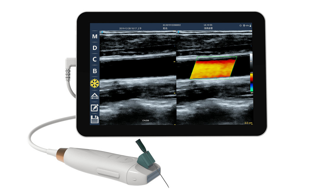 Scanner ad ultrasuoni portatile con sonda lineare ad alta frequenza 12MHZ per accurate procedure di accesso vascolare e inserimento PICC