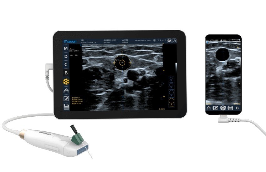 Scanner ecografico portatile a 20 mm di profondità per la valutazione vascolare periferica e l'accesso vascolare guidato da ultrasuoni