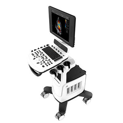 Analizzatore Chison Qbit 5 di ultrasuono di doppler di colore con il LED a 15 pollici