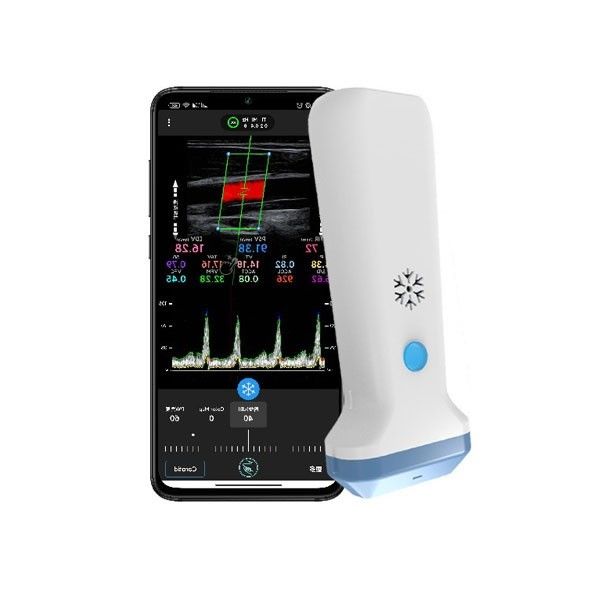 analizzatore portatile di ultrasuono di doppler di colore di 12.6cm per i professionisti di sanità