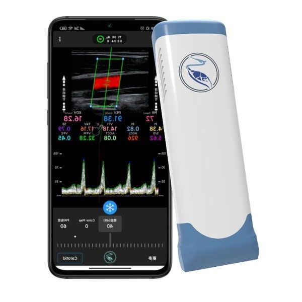 Pagine dell'analizzatore 100 di ultrasuono di Echo Color Doppler Wireless Handheld