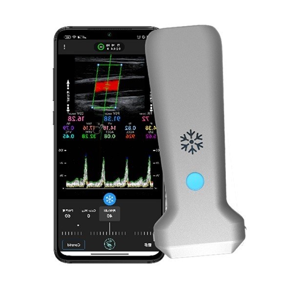Scanner a ultrasuoni portatile lineare wireless certificato CE | Sonda ecografica portatile Color Doppler da 8,3 MHz