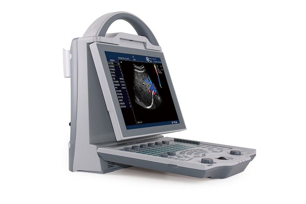 Sistema di ultrasuono di doppler di colore del computer portatile del livello di entrata 16GB 2D per la gravidanza