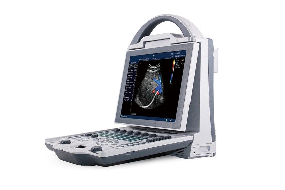 Sistema di ultrasuono di doppler di colore del computer portatile del livello di entrata 16GB 2D per la gravidanza