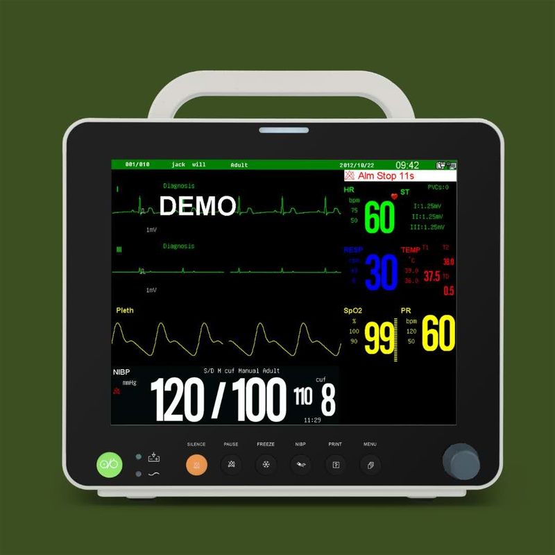 12,1» monitor pazienti di multi parametro veterinario dell'esposizione di TFT di colore con ECG