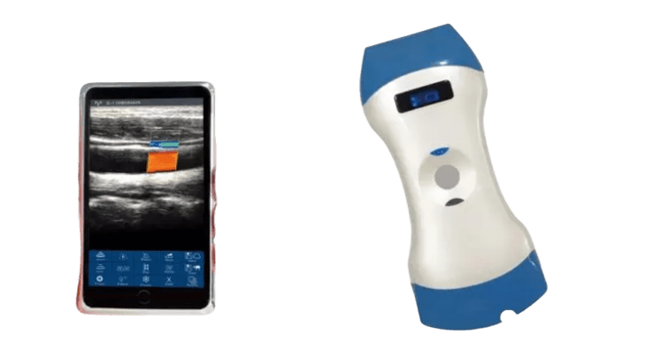 Sonda per ultrasuoni portatile wireless a doppia testa da 128 elementi: una sonda per imaging profondo, imaging superficiale e diagnosi al punto di cura