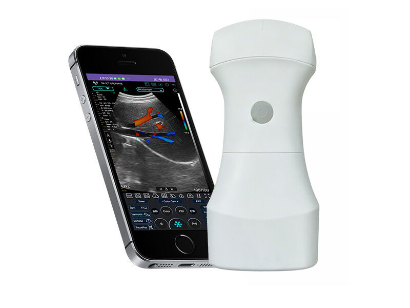 Scanner a ultrasuoni convesso tascabile wireless con batteria sostituibile per imaging clinico portatile