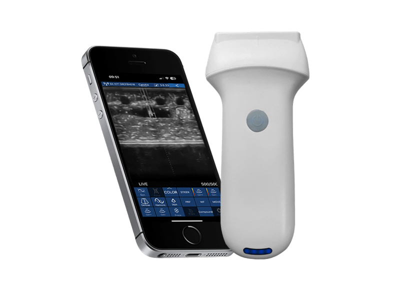 Sonda a ultrasuoni Color Doppler lineare per guida alla puntura con guida dell'ago in piano e fuori piano per il posizionamento del PICC