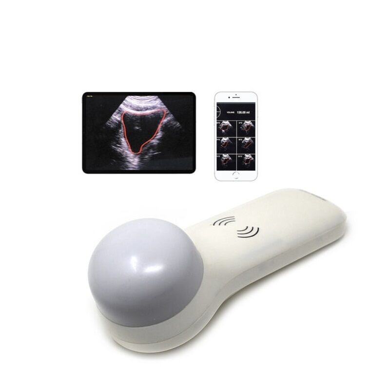 Scanner vescicale portatile wireless 4D per la misurazione del volume urinario al punto di cura